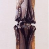 DALL-2